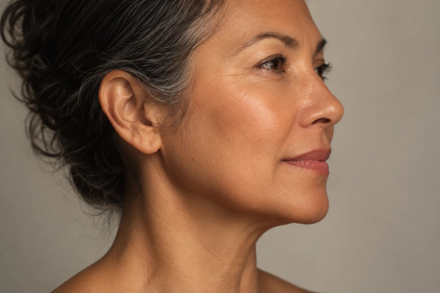 SMAS Facelift Areas Treated